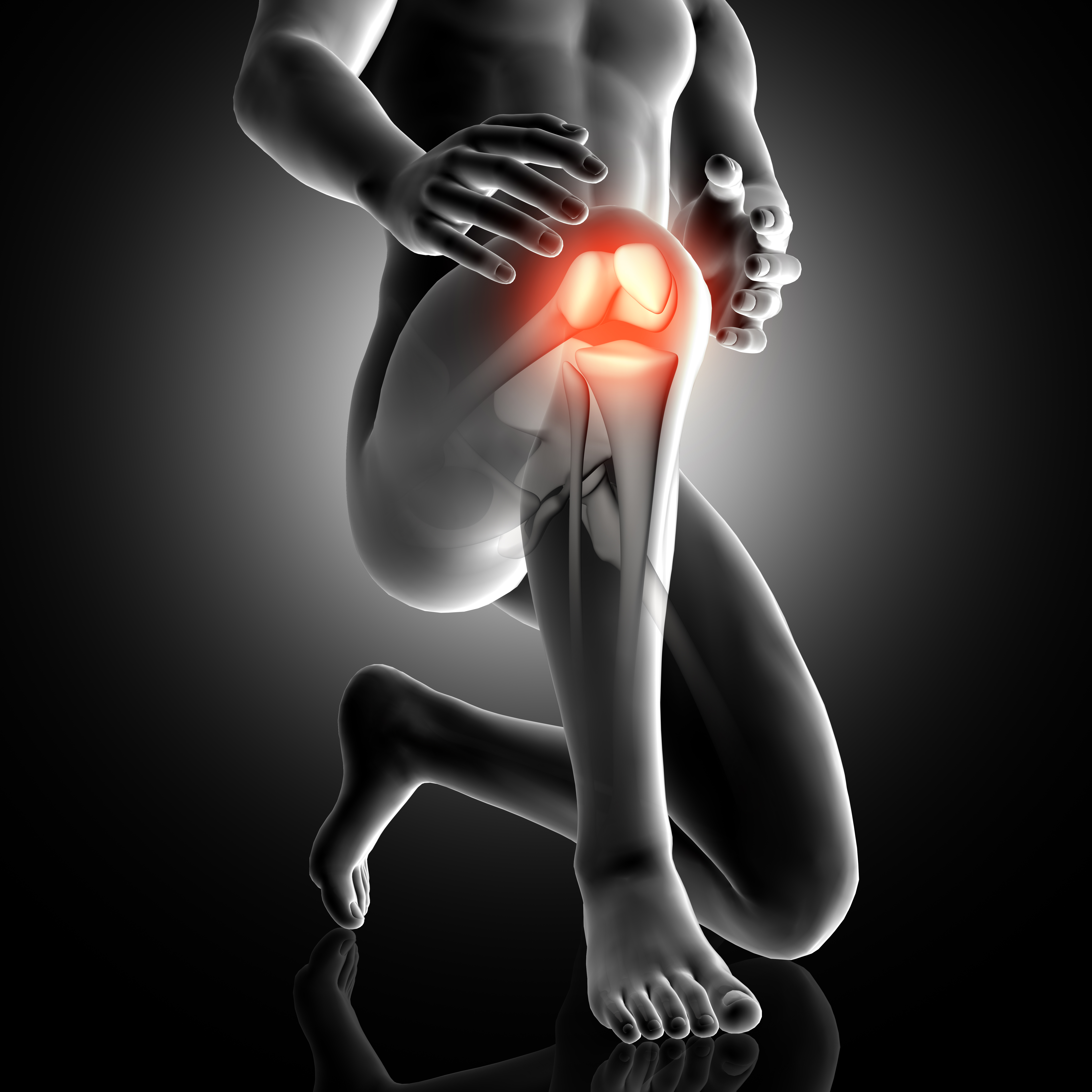 3D render of a male figure with knee highlighted in pain